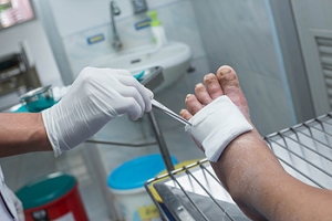 Treatment for Infected DFUs