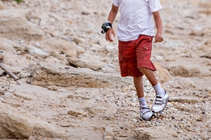 Two Categories of Clubfoot